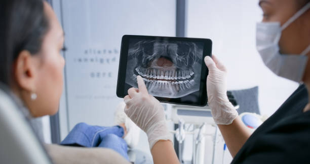 Licensed Wisdom Tooth Removal service in Rice, TX - Smile Center Dentistry